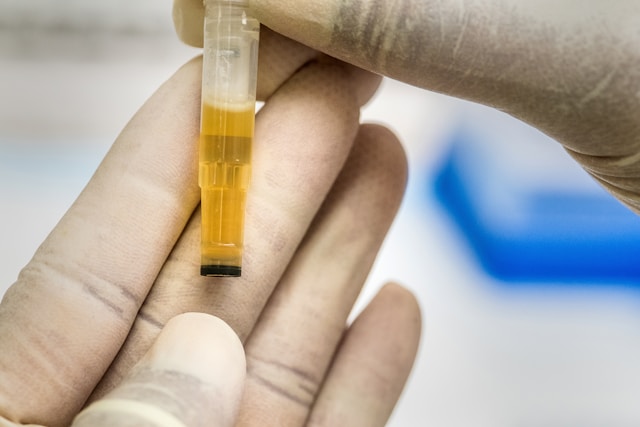 biotest